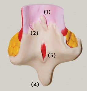 Die chronische Analfissur ist eine häufige Ursache von Blut im Stuhl und von Schmerzen