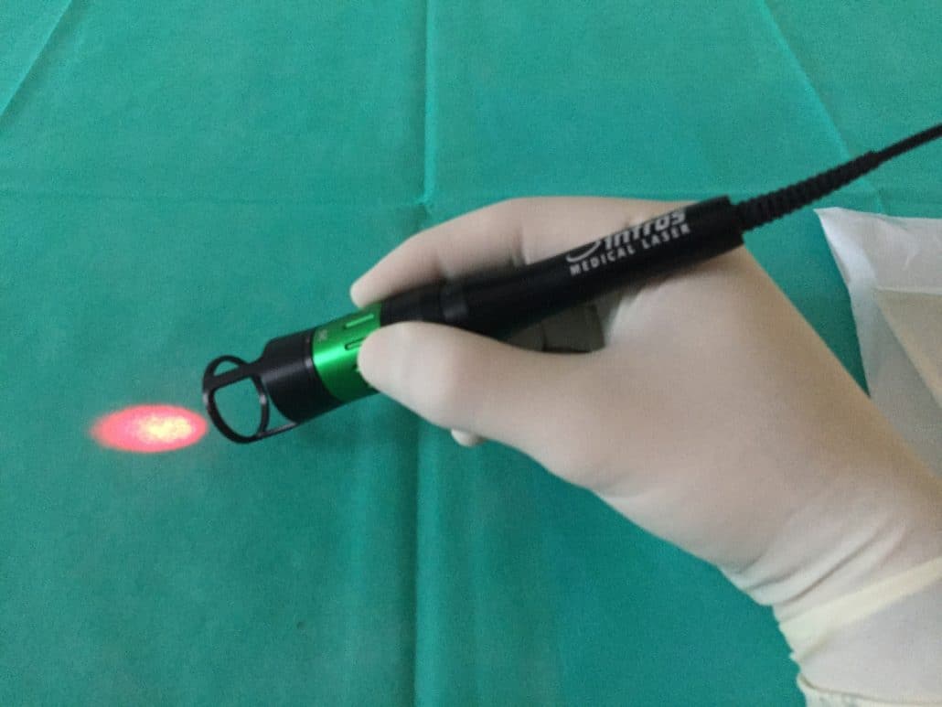 Low level laser therapy for the treatment of anal thrombosis